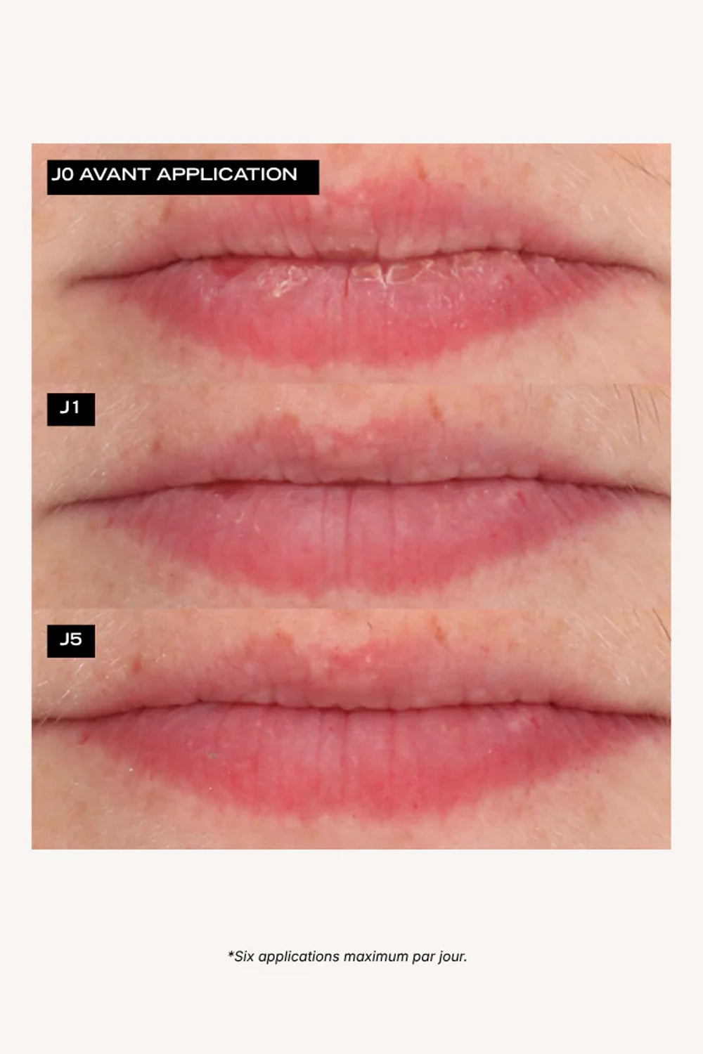 Source Nutrition Nourishing Lip Oil 5mL